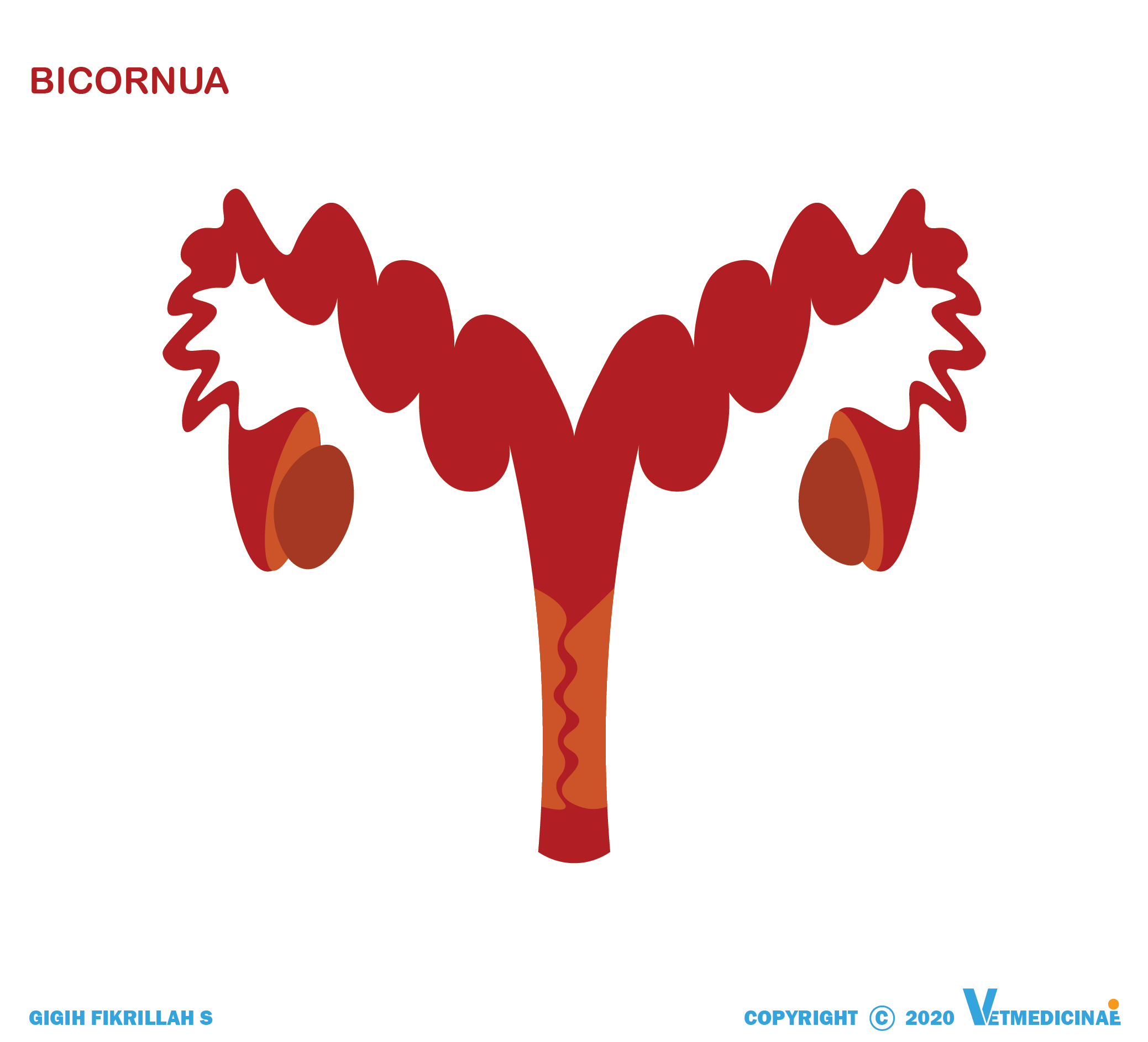 tipe uterus bicornua