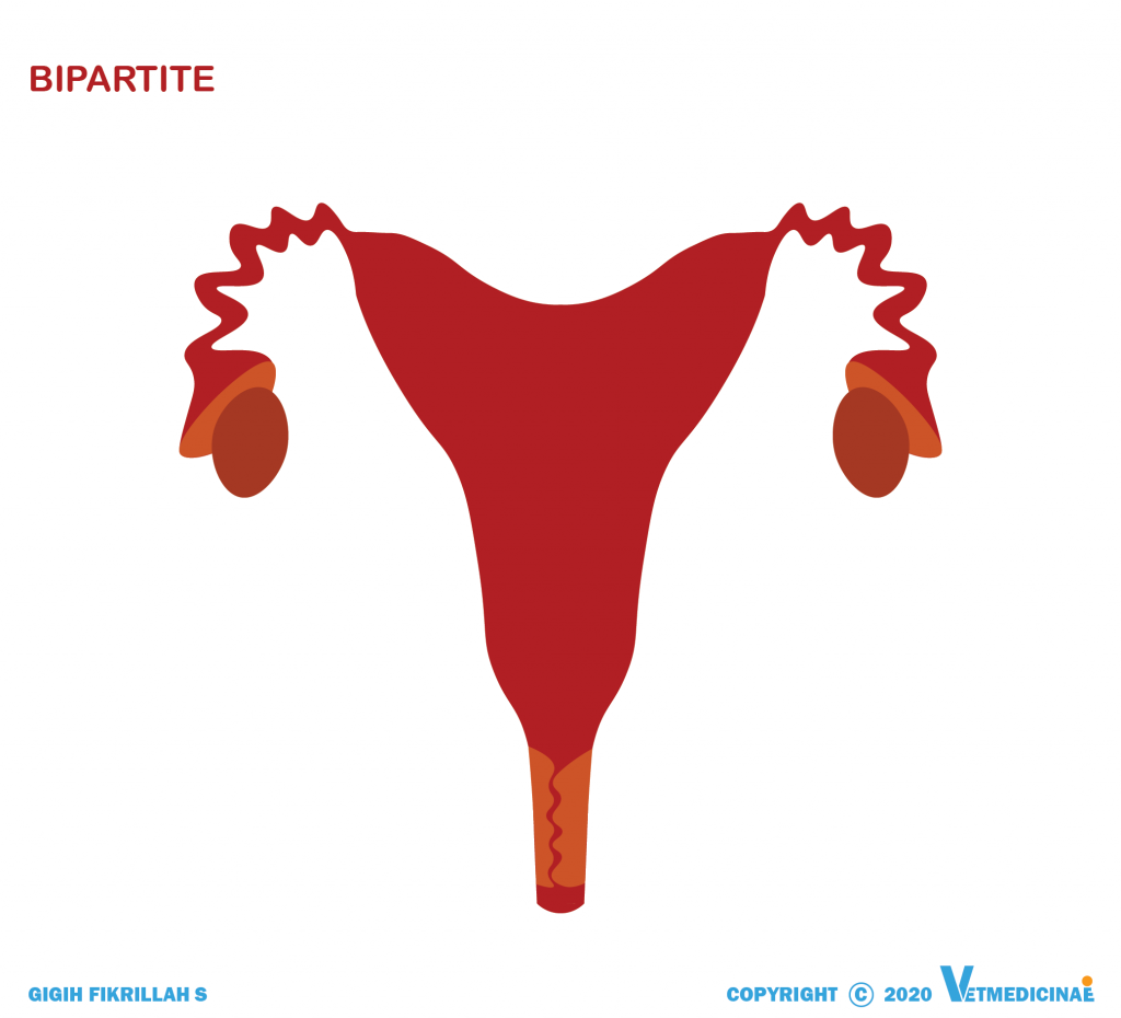tipe uterus bipartite