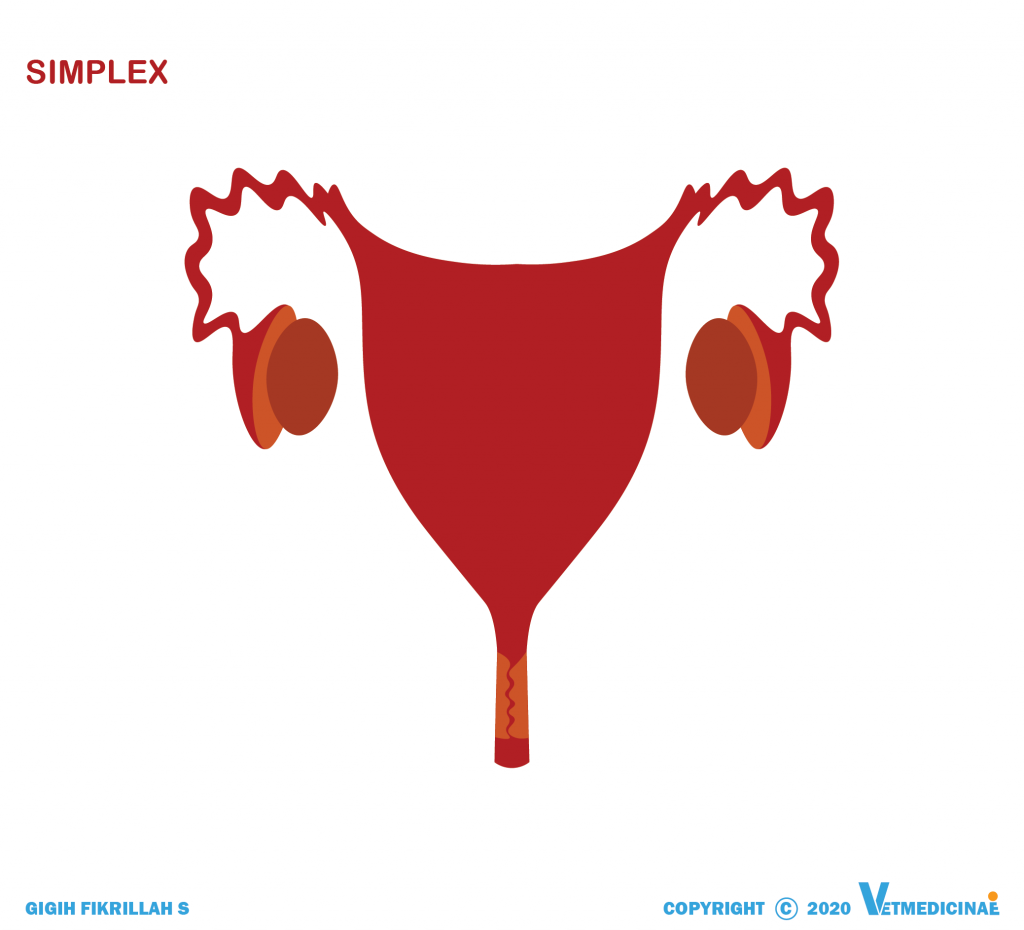tipe uterus simplex